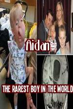 Watch Aidan The Rarest Boy In The World 1channel