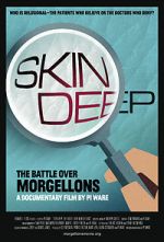 Watch Skin Deep: The Battle Over Morgellons 1channel