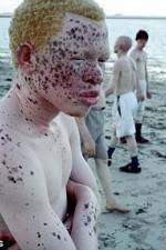 Watch Albino United 1channel