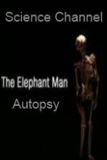 Watch Science Channel Elephant Man Autopsy 1channel