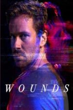 Watch Wounds 1channel