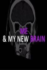 Watch Me & My New Brain 1channel