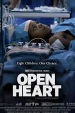 Watch Open Heart 1channel