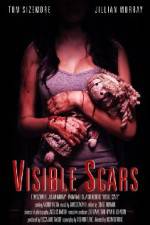 Watch Visible Scars 1channel