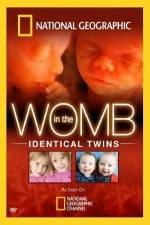 Watch National Geographic: In the Womb - Identical Twins 1channel