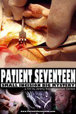 Watch Patient Seventeen 1channel