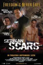 Watch Serbian Scars 1channel