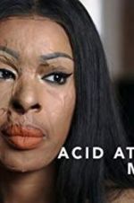 Watch Acid Attack: My Story 1channel