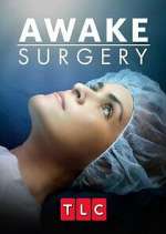 Watch Awake Surgery 1channel