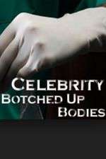 Watch Celebrity Botched Up Bodies 1channel